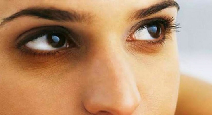 د سترګو لاندې تورې حلقې څنګه لرې کړو؟