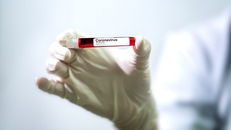 پر کرونا ویروس ۸ ناروغان مړه شول