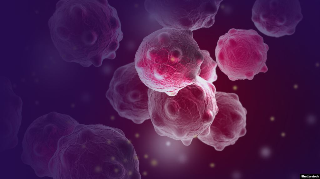 یوازې یو کال کې افغانستان کې د سرطان ناروغۍ ۲۰ زره پېښې ثبت شوي